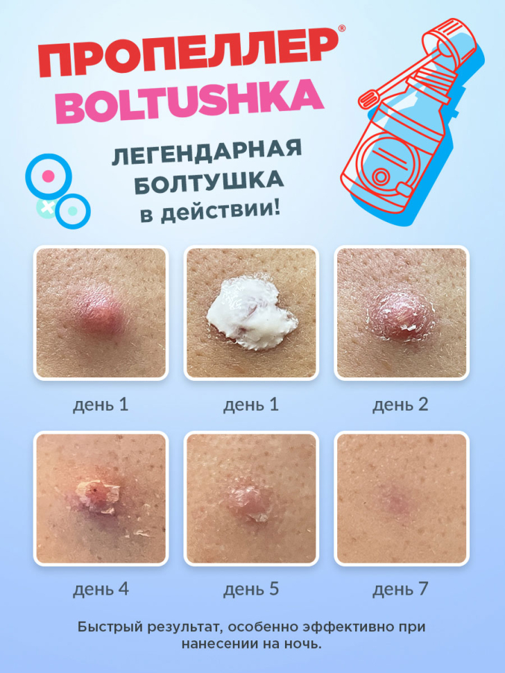 Салициловая суспензия для лица Boltushka от прыщей для локального нанесения, 25 мл